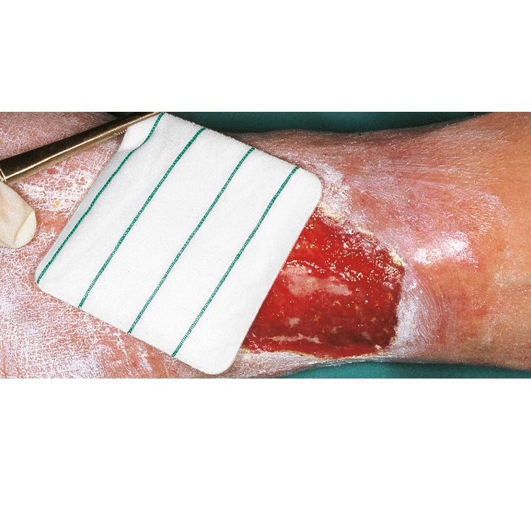 Opatrunki polimerowe i hydropolimerowe