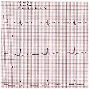 Papiery do EKG