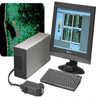 Ultrasonografy dermatologiczne