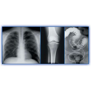 Filmy RTG – ogólnodiagnostyczne