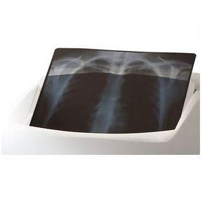 Filmy RTG – drukarki rentgenowskie