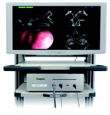 Systemy neuronawigacji