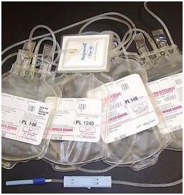 Zestaw do zlewania płytek