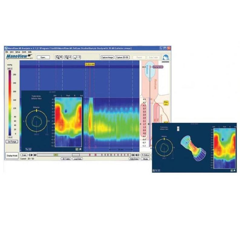 Manometry wysokiej rozdzielczości przewodu pokarmowego