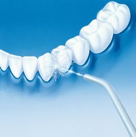 Irygatory dentystyczne - akcesoria