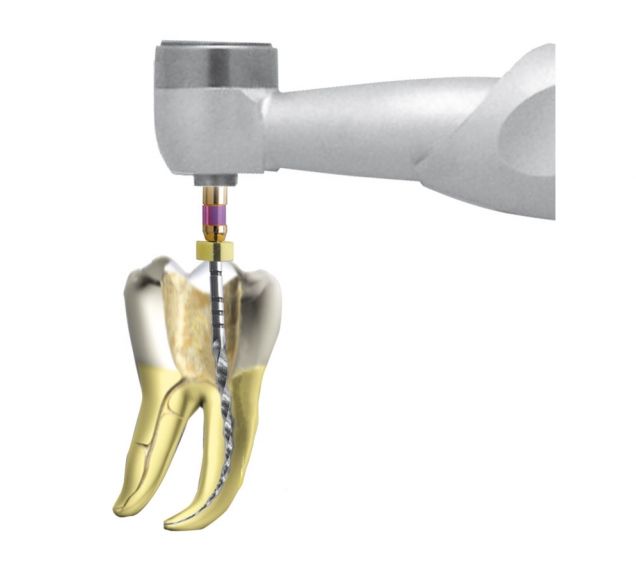 Kątnice endodontyczne