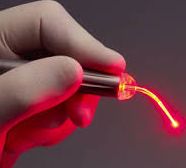 Lasery stomatologicznee