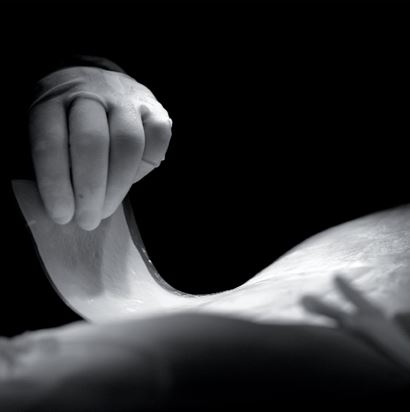 Matryce do regeneracji skóry właściwej