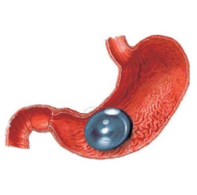 Balony żołądkowe do leczenia otyłości do endoskopów giętkich