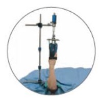 Dystraktory nadgarstka do artroskopii