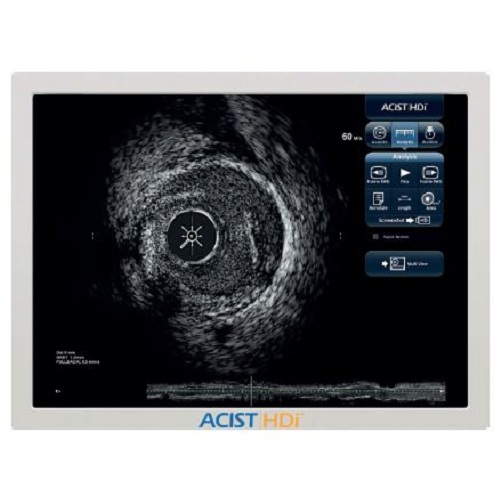 Ultrasonografy wewnątrznaczyniowe - IVUS