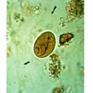 Barwniki do mikroskopii