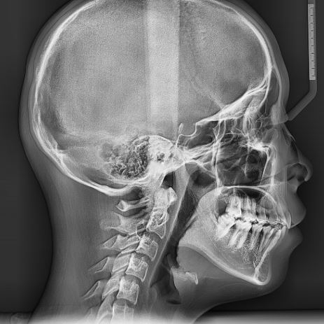 Oprogramowanie do archiwizacji danych w pracowni radiologicznej