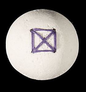 Implanty gałki ocznej