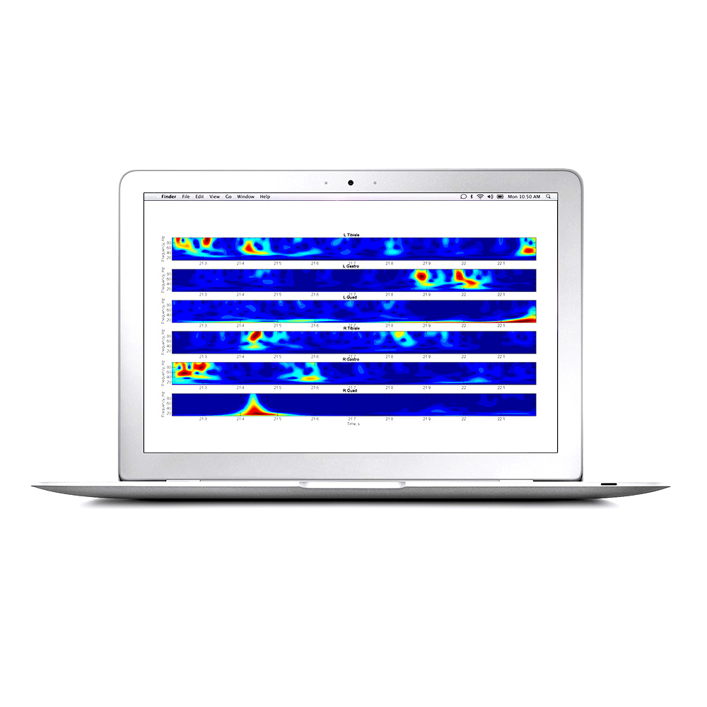 Oprogramowanie do elektromiografów (EMG)